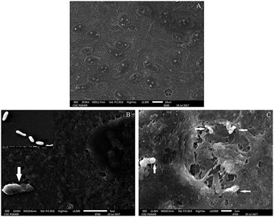 Transcriptional Profile of Mycobacterium tuberculosis in an in vitro Model of Intraocular Tuberculosis